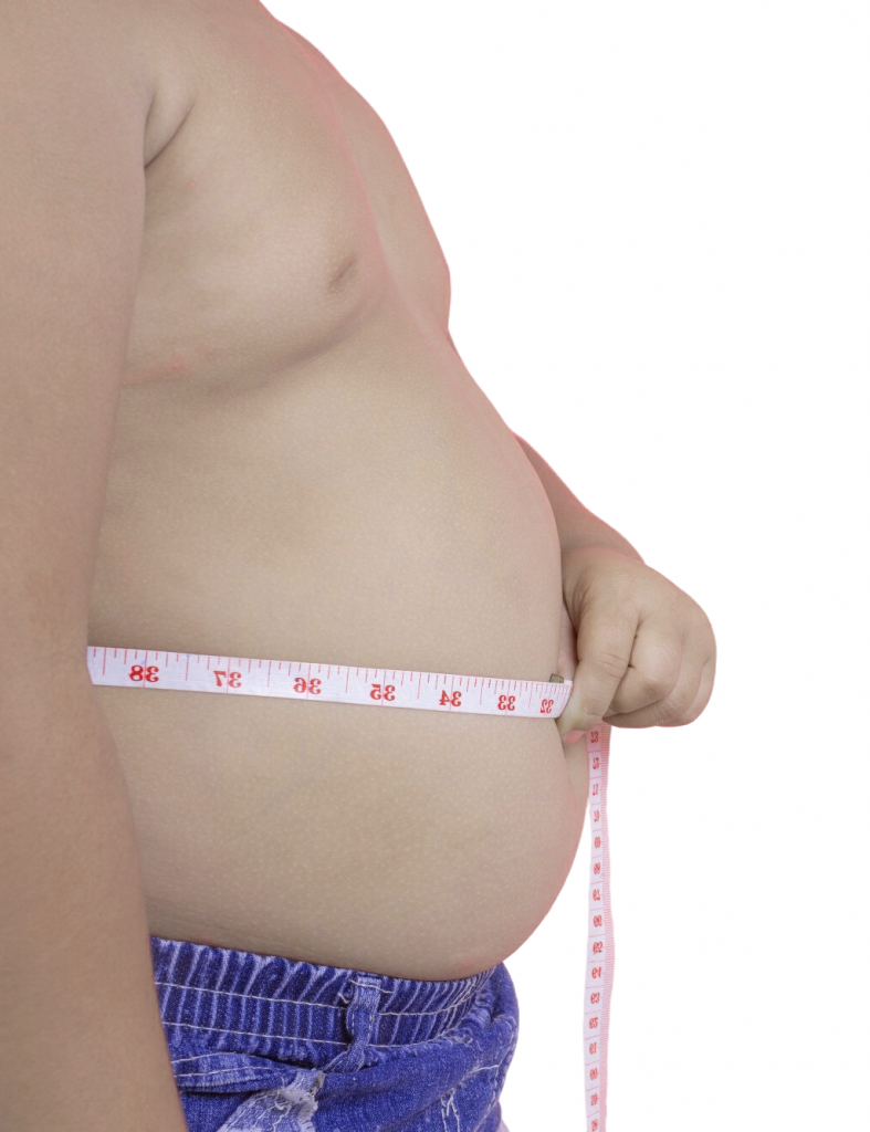 симптомы ожирения.png