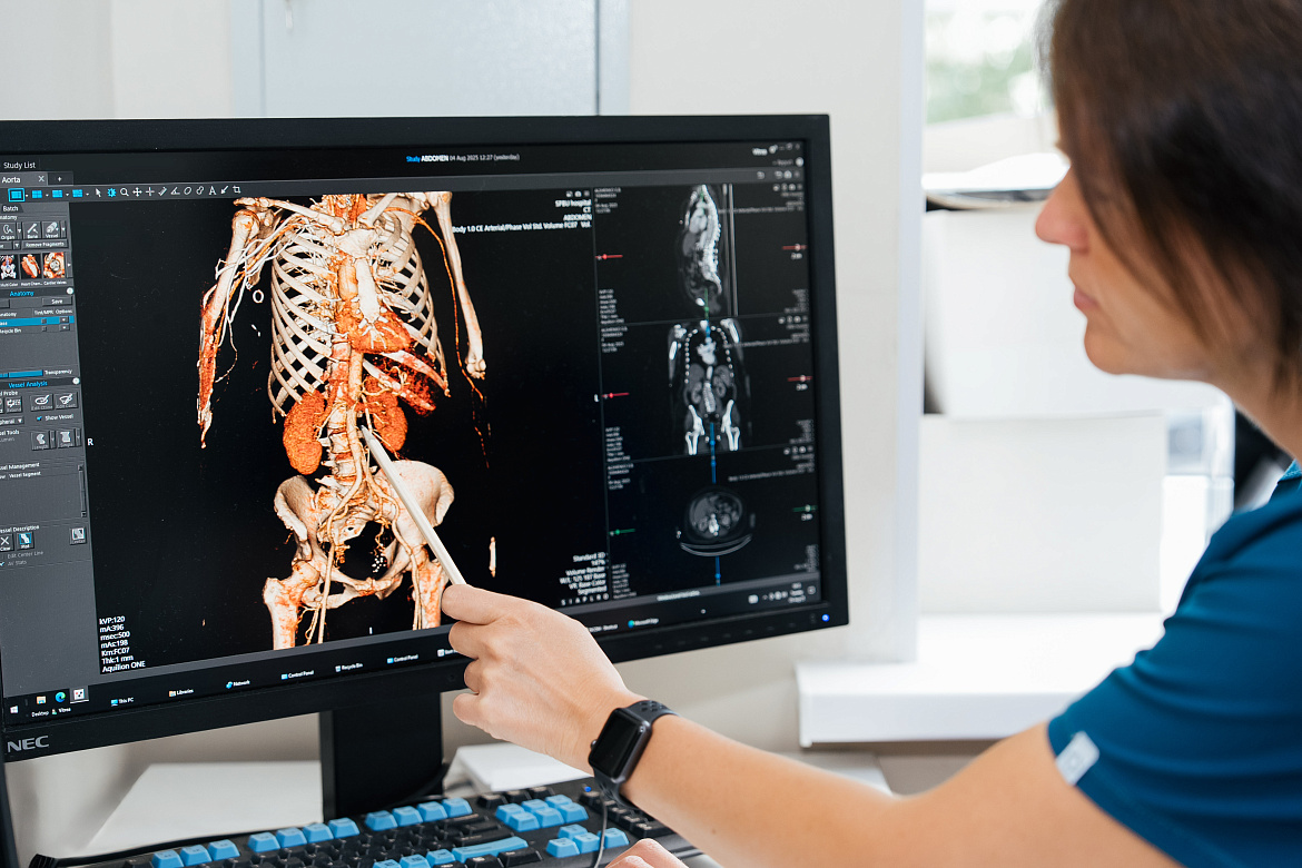 Компьютерная томография почек