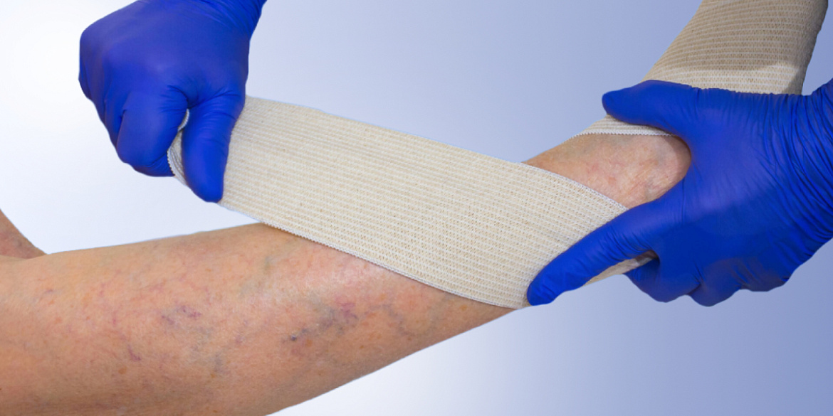 Посттромбическая болезнь