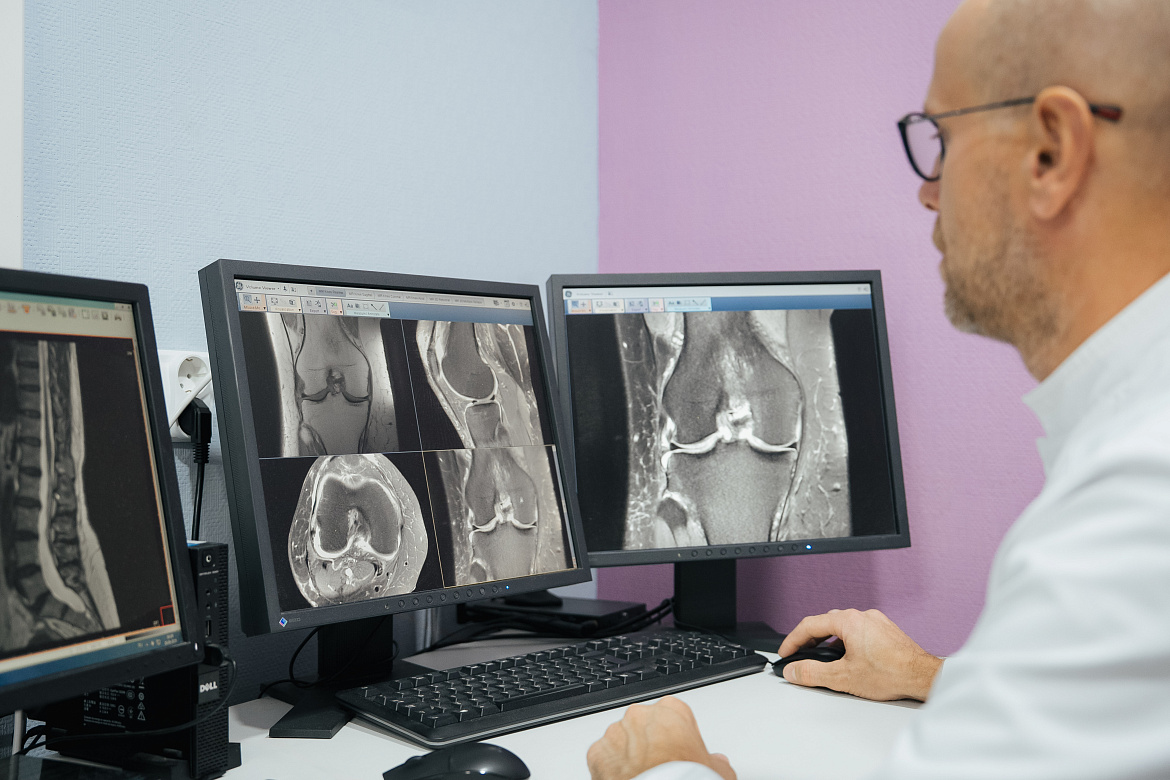 Магнитно-резонансная томография коленного сустава