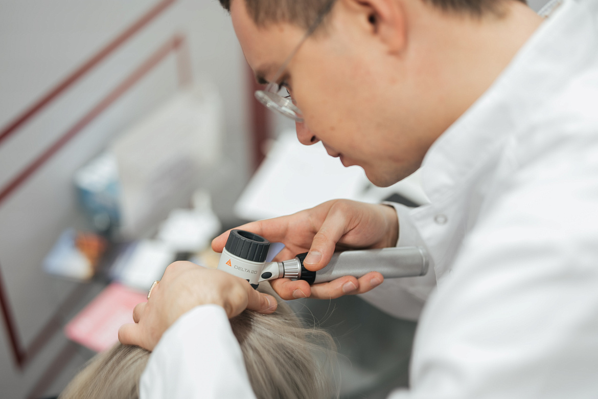 Себорейный дерматит