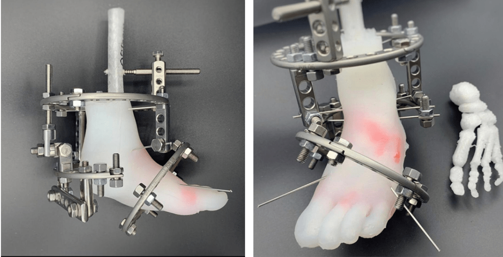 Рис.2 Использование 3Д моделей в силиконовой оболочке для выбора верной тактики лечения имитации вмешательства и отработки будущих действий.