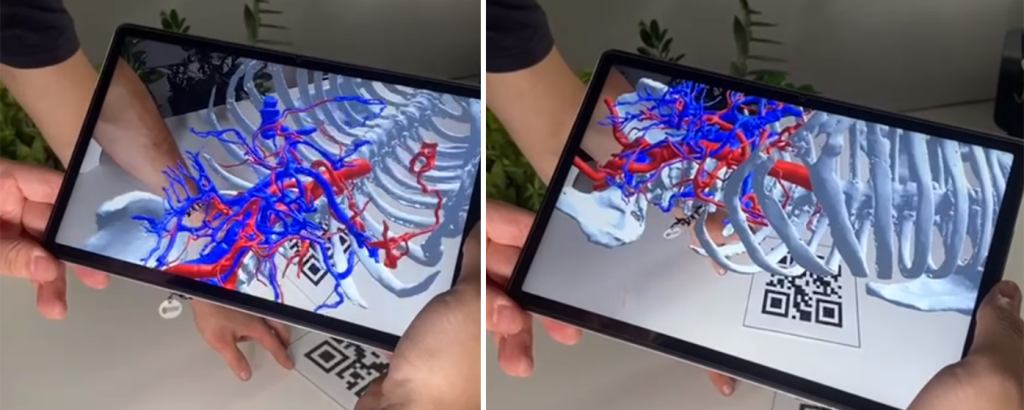  Рис. 7. Добиваясь удешевления технологий, мы получаем доступ для работы в таких сферах как дополненная и виртуальная реальность. Это рассматривается нами как вспомогательный инструмент для быстрой ориентации в ходе операций, на сложно разветвленных системах кровоснабжения и других видах вмешательств где это применимо.